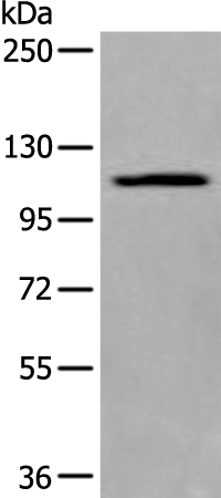 Gel: 6%SDS-PAGE Lysate: 40 microg Lane: A549 cell lysate Primary antibody: TA372029 (XYLT1 Antibody) at dilution 1/300 Secondary antibody: Goat anti rabbit IgG at 1/8000 dilution Exposure time: 1 minute