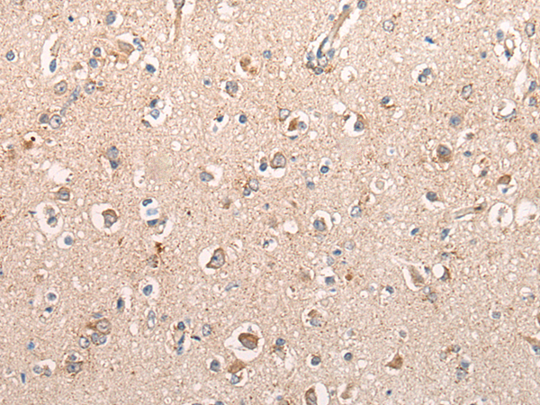 Immunohistochemistry of paraffin-embedded Human brain tissue using TA372138 (BMERB1 Antibody) at dilution 1/25 (Original magnification: x200)