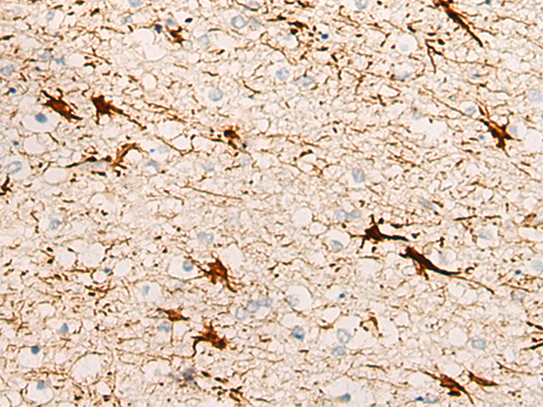 Immunohistochemistry of paraffin-embedded Human brain tissue using TA372395 (DBX2 Antibody) at dilution 1/20 (Original magnification: x200)