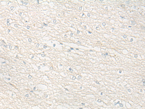Immunohistochemistry of paraffin-embedded Human brain tissue using TA372442 (DUOX2 Antibody) at dilution 1/20 (Original magnification: x200)