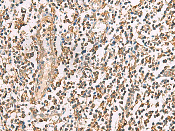 Immunohistochemistry of paraffin-embedded Human tonsil tissue using TA372528 (P3H2 Antibody) at dilution 1/35 (Original magnification: x200)