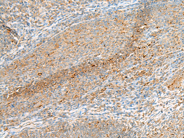 Immunohistochemistry of paraffin-embedded Human tonsil tissue using TA372579 (IZUMO1R Antibody) at dilution 1/40 (Original magnification: x200)
