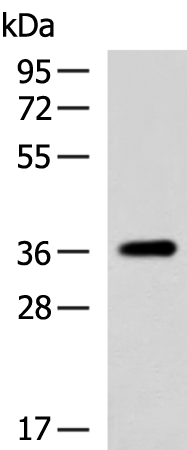 Gel: 8%SDS-PAGE Lysate: 40 microg Lane: Raji cell lysate Primary antibody: TA372599 (GALR3 Antibody) at dilution 1/700 Secondary antibody: Goat anti rabbit IgG at 1/5000 dilution Exposure time: 1 minute