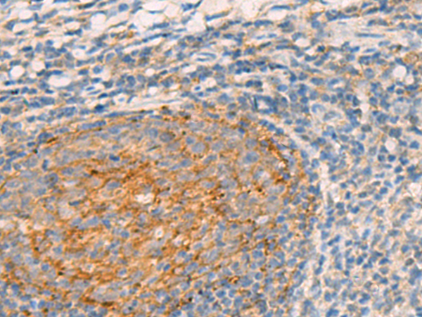 Immunohistochemistry of paraffin-embedded Human tonsil tissue using TA372679 (WLS Antibody) at dilution 1/45 (Original magnification: x200)