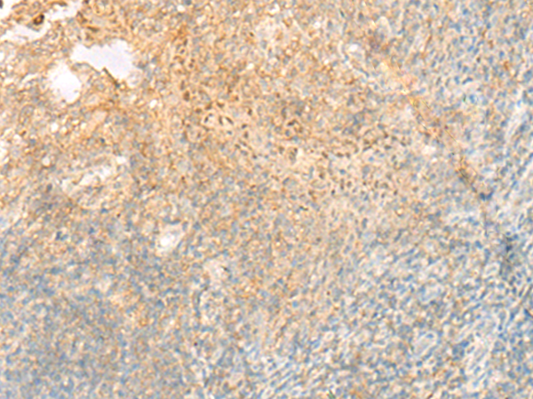 Immunohistochemistry of paraffin-embedded Human tonsil tissue using TA372680 (PROKR1 Antibody) at dilution 1/35 (Original magnification: x200)
