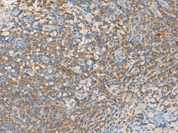 Immunohistochemistry of paraffin-embedded Human tonsil tissue using TA372691 (GRIK5 Antibody) at dilution 1/40 (Original magnification: x200)
