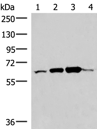 Gel: 6%SDS-PAGE Lysate: 40 microg Lane 1-4: Human fetal liver tissue PC3 Raji Hela cell lysates Primary antibody: TA372711 (ZNF85 Antibody) at dilution 1/350 Secondary antibody: Goat anti rabbit IgG at 1/8000 dilution Exposure time: 10 seconds