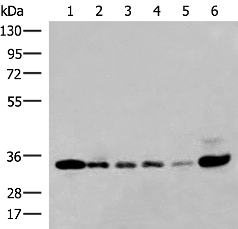 Gel: 8%SDS-PAGE Lysate: 40 microg Lane 1-6: 293T K562 HepG2 231 Hela and Jurkat cell lysates Primary antibody: TA372724 (HNRNPA1L2 Antibody) at dilution 1/250 Secondary antibody: Goat anti rabbit IgG at 1/8000 dilution Exposure time: 1 minute