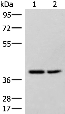Gel: 8%SDS-PAGE Lysate: 40 microg Lane 1-2: Hela and 231 cell lysates Primary antibody: TA372750 (HPDL Antibody) at dilution 1/400 Secondary antibody: Goat anti rabbit IgG at 1/8000 dilution Exposure time: 1 minute