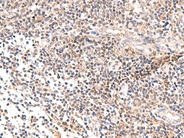 Immunohistochemistry of paraffin-embedded Human tonsil tissue using TA372771 (IL36B Antibody) at dilution 1/40 (Original magnification: x200)