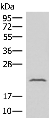 Gel: 12%SDS-PAGE Lysate: 40 microg Lane: Human fetal liver tissue lysate Primary antibody: TA372787 (IFNA8 Antibody) at dilution 1/500 Secondary antibody: Goat anti rabbit IgG at 1/8000 dilution Exposure time: 1 minute