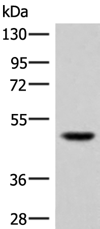 Gel: 8%SDS-PAGE Lysate: 40 microg Lane: TM4 cell lysate Primary antibody: TA372798 (IRGC Antibody) at dilution 1/300 Secondary antibody: Goat anti rabbit IgG at 1/8000 dilution Exposure time: 20 seconds