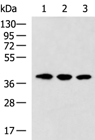 Gel: 8%SDS-PAGE Lysate: 40 microg Lane 1-3: 293T HepG2 and SKOV3 cell lysates Primary antibody: TA372808 (ISY1-RAB43 Antibody) at dilution 1/600 Secondary antibody: Goat anti rabbit IgG at 1/5000 dilution Exposure time: 90 seconds