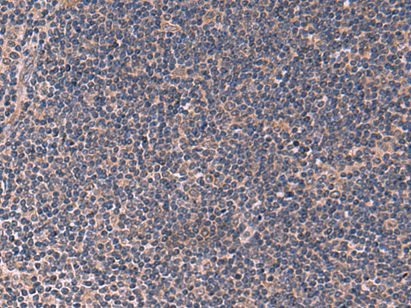 Immunohistochemistry of paraffin-embedded Human tonsil tissue using TA372812 (ITPR2 Antibody) at dilution 1/60 (Original magnification: x200)