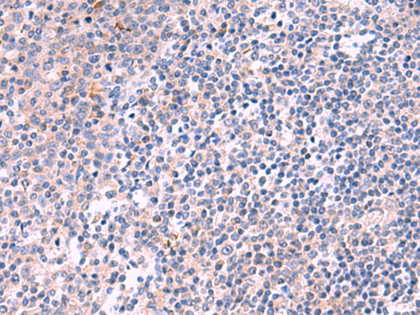 Immunohistochemistry of paraffin-embedded Human tonsil tissue using TA372826 (KANK3 Antibody) at dilution 1/35 (Original magnification: x200)