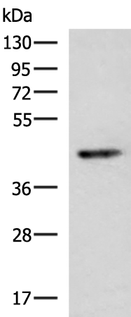 Gel: 8%SDS-PAGE Lysate: 40 microg Lane: Human cerebrum tissue lysate Primary antibody: TA372844 (KCNK2 Antibody) at dilution 1/200 Secondary antibody: Goat anti rabbit IgG at 1/5000 dilution Exposure time: 1 minute