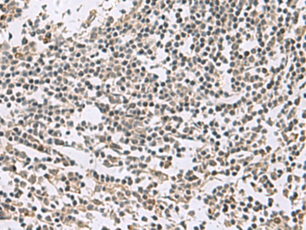 Immunohistochemistry of paraffin-embedded Human tonsil tissue using TA372855 (ABCA10 Antibody) at dilution 1/35 (Original magnification: x200)