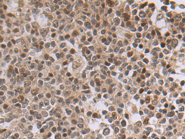 Immunohistochemistry of paraffin-embedded Human tonsil tissue using TA372936 (MXD4 Antibody) at dilution 1/50 (Original magnification: x200)