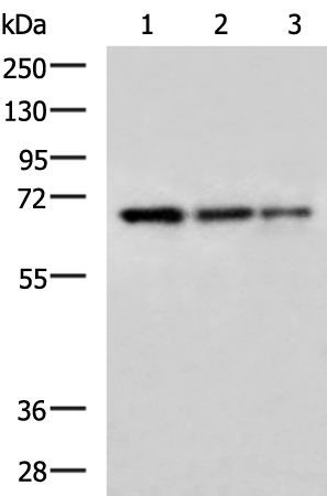 Gel: 8%SDS-PAGE Lysate: 40 microg Lane 1-3: HepG2 cell Mouse stomach tissue TM4 cell lysates Primary antibody: TA372962 (DAZ4 Antibody) at dilution 1/800 Secondary antibody: Goat anti rabbit IgG at 1/5000 dilution Exposure time: 5 minutes