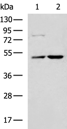 Gel: 8%SDS-PAGE Lysate: 40 microg Lane 1-2: NIH/3T3 cell HepG2 cell lysates Primary antibody: TA373061 (SMYD2 Antibody) at dilution 1/1000 Secondary antibody: Goat anti rabbit IgG at 1/5000 dilution Exposure time: 10 seconds