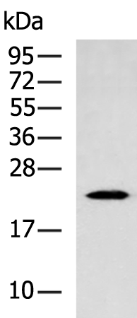 Gel: 12%SDS-PAGE Lysate: 40 microg Lane: A549 cell lysate Primary antibody: TA373076 (CBLN1 Antibody) at dilution 1/1000 Secondary antibody: Goat anti rabbit IgG at 1/5000 dilution Exposure time: 40 seconds