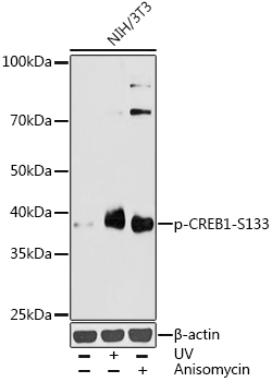 TA363828, Clone lambda-1 Biotin, human tonsil, frozen section
