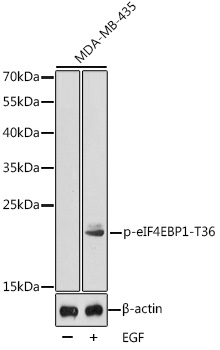 TA363829, Clone Kappa-117 Biotin, human tonsil, frozen section