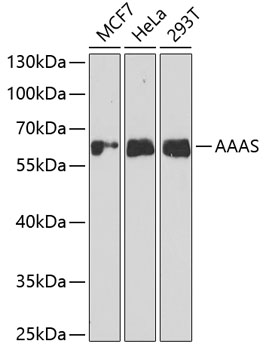 Western blot analysis of extracts of various cell lines, using AAAS antibody (TA373107) at 1:1000 dilution. - Secondary antibody: HRP Goat Anti-Rabbit IgG (H+L) at 1:10000 dilution. - Lysates/proteins: 25ug per lane. - Blocking buffer: 3% nonfat dry milk in TBST. - Detection: ECL Basic Kit . - Exposure time: 30s.