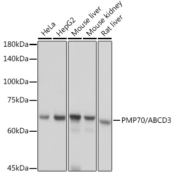 Western blot analysis of extracts of various cell lines, using PMP70/PMP70/ABCD3 antibody (TA373142) at 1:1000 dilution. - Secondary antibody: HRP Goat Anti-Rabbit IgG (H+L) at 1:10000 dilution. - Lysates/proteins: 25ug per lane. - Blocking buffer: 3% nonfat dry milk in TBST. - Detection: ECL Basic Kit . - Exposure time: 1s.