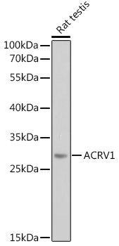 HEK293T cells were transfected with the pCMV6-ENTRY control (Left lane) or pCMV6-ENTRY EGFR (RC217384, Right lane) cDNA for 48 hrs and lysed. Equivalent amounts of cell lysates (5 ug per lane) were separated by SDS-PAGE and immunoblotted with anti-EGFR. Positive lysates LY417434 (100 ug) and LC417434 (20 ug) can be purchased separately from OriGene.