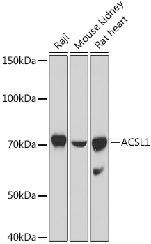 Western blot analysis of extracts of various cell lines, using ACSL1 antibody (TA373211) at 1:1000 dilution. - Secondary antibody: HRP Goat Anti-Rabbit IgG (H+L) at 1:10000 dilution. - Lysates/proteins: 25ug per lane. - Blocking buffer: 3% nonfat dry milk in TBST. - Detection: ECL Basic Kit . - Exposure time: 10s.