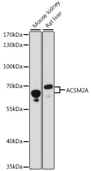 Western blot analysis of extracts of various cell lines, using ACSM2A antibody (TA373216) at 1:1000 dilution. - Secondary antibody: HRP Goat Anti-Rabbit IgG (H+L) at 1:10000 dilution. - Lysates/proteins: 25ug per lane. - Blocking buffer: 3% nonfat dry milk in TBST. - Detection: ECL Basic Kit . - Exposure time: 60s.