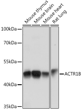 Western blot analysis of extracts of various cell lines, using ACTR1B Rabbit pAb (TA373235) at 1:1000 dilution. - Secondary antibody: HRP Goat Anti-Rabbit IgG (H+L) at 1:10000 dilution. - Lysates/proteins: 25ug per lane. - Blocking buffer: 3% nonfat dry milk in TBST. - Detection: ECL Basic Kit . - Exposure time: 1s.