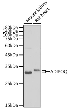 Western blot analysis of extracts of various cell lines, using ADIPOQ antibody (TA373303) at 1:500 dilution. - Secondary antibody: HRP Goat Anti-Rabbit IgG (H+L) at 1:10000 dilution. - Lysates/proteins: 25ug per lane. - Blocking buffer: 3% nonfat dry milk in TBST. - Detection: ECL Basic Kit . - Exposure time: 10s.