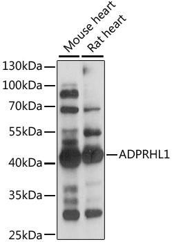 Western blot analysis of extracts of various cell lines, using ADPRHL1 antibody (TA373315) at 1:1000 dilution. - Secondary antibody: HRP Goat Anti-Rabbit IgG (H+L) at 1:10000 dilution. - Lysates/proteins: 25ug per lane. - Blocking buffer: 3% nonfat dry milk in TBST. - Detection: ECL Enhanced Kit . - Exposure time: 3s.