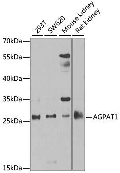 Western blot analysis of extracts of various cell lines, using AGPAT1 antibody (TA373352) at 1:1000 dilution. - Secondary antibody: HRP Goat Anti-Rabbit IgG (H+L) at 1:10000 dilution. - Lysates/proteins: 25ug per lane. - Blocking buffer: 3% nonfat dry milk in TBST. - Detection: ECL Basic Kit . - Exposure time: 90s.