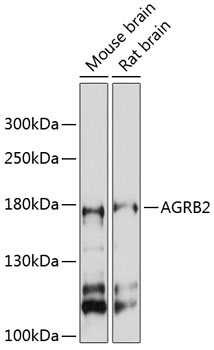 HEK293T cells were transfected with the pCMV6-ENTRY control (Left lane) or pCMV6-ENTRY OTC (RC214662, Right lane) cDNA for 48 hrs and lysed. Equivalent amounts of cell lysates (5 ug per lane) were separated by SDS-PAGE and immunoblotted with anti-OTC.