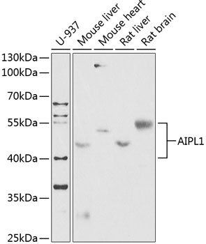 Western blot analysis of extracts of various cell lines, using AIPL1 antibody (TA373383) at 1:1000 dilution. - Secondary antibody: HRP Goat Anti-Rabbit IgG (H+L) at 1:10000 dilution. - Lysates/proteins: 25ug per lane. - Blocking buffer: 3% nonfat dry milk in TBST. - Detection: ECL Enhanced Kit . - Exposure time: 90s.