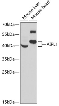 Western blot analysis of extracts of various cell lines, using AIPL1 antibody (TA373384) at 1:1000 dilution. - Secondary antibody: HRP Goat Anti-Rabbit IgG (H+L) at 1:10000 dilution. - Lysates/proteins: 25ug per lane. - Blocking buffer: 3% nonfat dry milk in TBST. - Detection: ECL Basic Kit . - Exposure time: 90s.