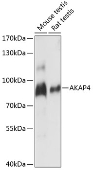 Western blot analysis of extracts of various cell lines, using AKAP4 antibody (TA373395) at 1:1000 dilution. - Secondary antibody: HRP Goat Anti-Rabbit IgG (H+L) at 1:10000 dilution. - Lysates/proteins: 25ug per lane. - Blocking buffer: 3% nonfat dry milk in TBST. - Detection: ECL Enhanced Kit . - Exposure time: 3s.