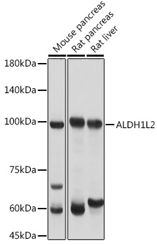 Western blot analysis of extracts of various cell lines, using ALDH1L2 antibody (TA373440) at 1:3000 dilution. - Secondary antibody: HRP Goat Anti-Rabbit IgG (H+L) at 1:10000 dilution. - Lysates/proteins: 25ug per lane. - Blocking buffer: 3% nonfat dry milk in TBST. - Detection: ECL Basic Kit . - Exposure time: 1s.