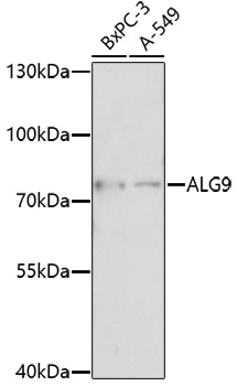 Western blot analysis of extracts of various cell lines, using ALG9 antibody (TA373457) at 1:1000 dilution. - Secondary antibody: HRP Goat Anti-Rabbit IgG (H+L) at 1:10000 dilution. - Lysates/proteins: 25ug per lane. - Blocking buffer: 3% nonfat dry milk in TBST. - Detection: ECL Enhanced Kit . - Exposure time: 90s.