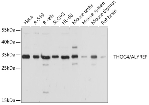 Western blot analysis of extracts of various cell lines, using THOC4/THOC4/ALYREF antibody (TA373480) at 1:1000 dilution. - Secondary antibody: HRP Goat Anti-Rabbit IgG (H+L) at 1:10000 dilution. - Lysates/proteins: 25ug per lane. - Blocking buffer: 3% nonfat dry milk in TBST. - Detection: ECL Basic Kit . - Exposure time: 5s.