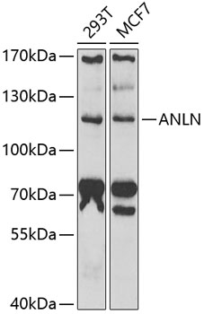 Western blot analysis of extracts of various cell lines, using ANLN antibody (TA373529) at 1:1000 dilution. - Secondary antibody: HRP Goat Anti-Rabbit IgG (H+L) at 1:10000 dilution. - Lysates/proteins: 25ug per lane. - Blocking buffer: 3% nonfat dry milk in TBST. - Detection: ECL Basic Kit . - Exposure time: 90s.