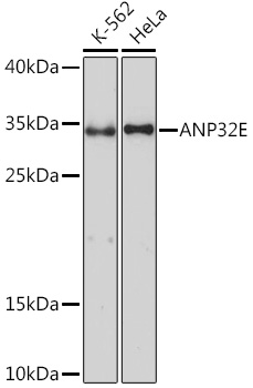 Western blot analysis of extracts of various cell lines, using ANP32E Rabbit pAb (TA373535) at 1:1000 dilution. - Secondary antibody: HRP Goat Anti-Rabbit IgG (H+L) at 1:10000 dilution. - Lysates/proteins: 25ug per lane. - Blocking buffer: 3% nonfat dry milk in TBST. - Detection: ECL Basic Kit . - Exposure time: 10s.