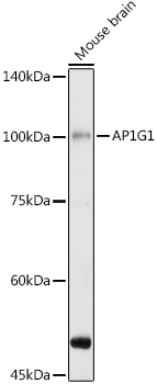 Western blot analysis of extracts of various cell lines, using AP1G1 antibody (TA373555) at 1:1000 dilution. - Secondary antibody: HRP Goat Anti-Rabbit IgG (H+L) at 1:10000 dilution. - Lysates/proteins: 25ug per lane. - Blocking buffer: 3% nonfat dry milk in TBST. - Detection: ECL Basic Kit . - Exposure time: 20s.