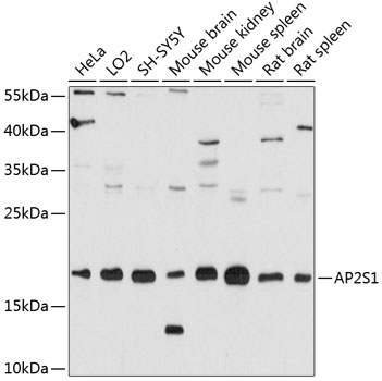 Western blot analysis of extracts of various cell lines, using AP2S1 antibody (TA373563) at 1:3000 dilution. - Secondary antibody: HRP Goat Anti-Rabbit IgG (H+L) at 1:10000 dilution. - Lysates/proteins: 25ug per lane. - Blocking buffer: 3% nonfat dry milk in TBST. - Detection: ECL Basic Kit . - Exposure time: 20s.