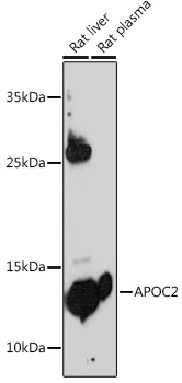 Western blot analysis of extracts of various cell lines, using APOC2 antibody (TA373597) at 1:500 dilution. - Secondary antibody: HRP Goat Anti-Rabbit IgG (H+L) at 1:10000 dilution. - Lysates/proteins: 25ug per lane. - Blocking buffer: 3% nonfat dry milk in TBST. - Detection: ECL Basic Kit . - Exposure time: 180s.