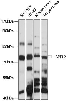 Western blot analysis of extracts of various cell lines, using APPL2 antibody (TA373612) at 1:1000 dilution. - Secondary antibody: HRP Goat Anti-Rabbit IgG (H+L) at 1:10000 dilution. - Lysates/proteins: 25ug per lane. - Blocking buffer: 3% nonfat dry milk in TBST. - Detection: ECL Basic Kit . - Exposure time: 90s.