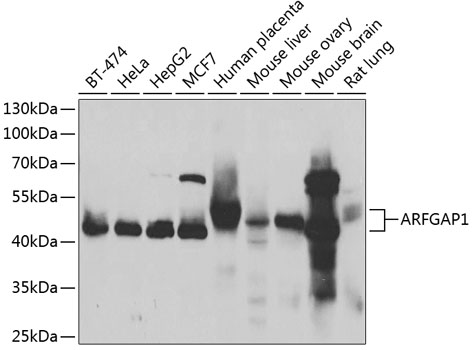Western blot analysis of extracts of various cell lines, using ARFGAP1 antibody (TA373641) at 1:1000 dilution. - Secondary antibody: HRP Goat Anti-Rabbit IgG (H+L) at 1:10000 dilution. - Lysates/proteins: 25ug per lane. - Blocking buffer: 3% nonfat dry milk in TBST. - Detection: ECL Basic Kit . - Exposure time: 3s.